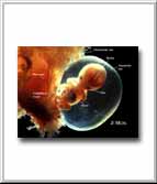 Human Embryo at 2 months