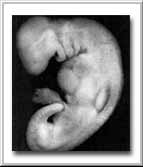 Human embryo at 28 days